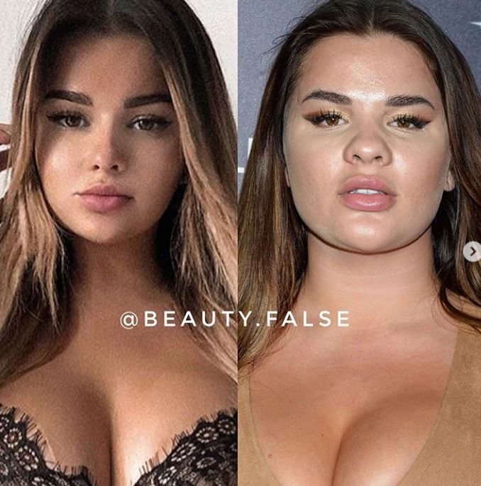 Tak wyglądają gwiazdy bez Photoshopa. "Beauty False" pokazują prawdę