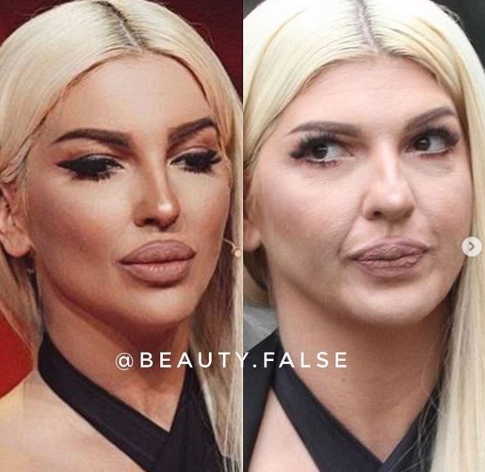 Tak wyglądają gwiazdy bez Photoshopa. "Beauty False" pokazują prawdę